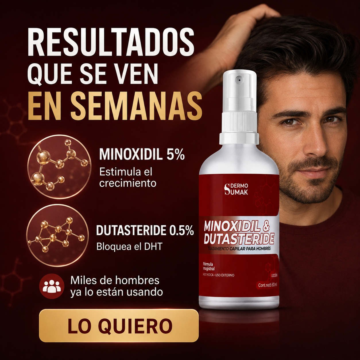 Loción Capilar Anticaída Resultados reales con Minoxidil + Dutasteride "